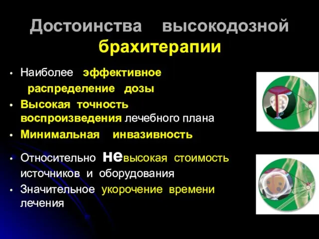 Достоинства высокодозной брахитерапии Наиболее эффективное распределение дозы Высокая точность воспроизведения лечебного