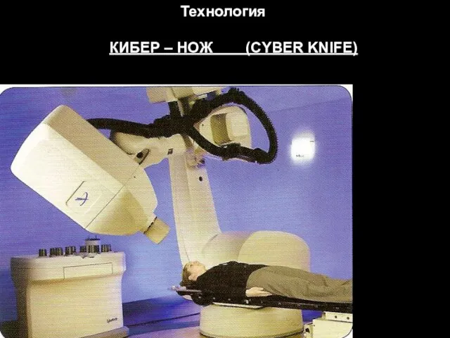 Технология КИБЕР – НОЖ (CYBER KNIFE)