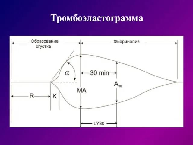 Тромбоэластограмма