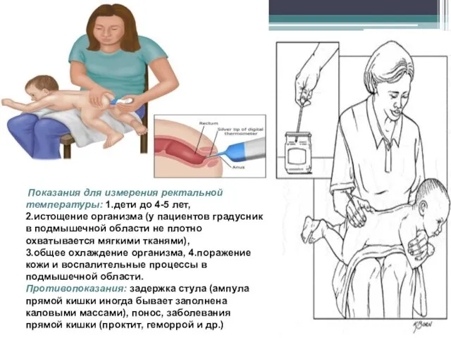 Показания для измерения ректальной температуры: 1.дети до 4-5 лет, 2.истощение организма