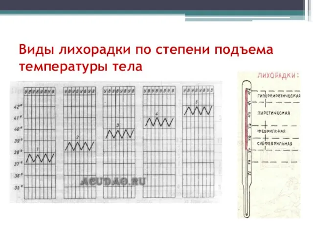 Виды лихорадки по степени подъема температуры тела