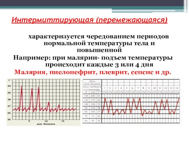 Интермиттирующая (перемежающаяся) характеризуется чередованием периодов нормальной температуры тела и повышенной Например: