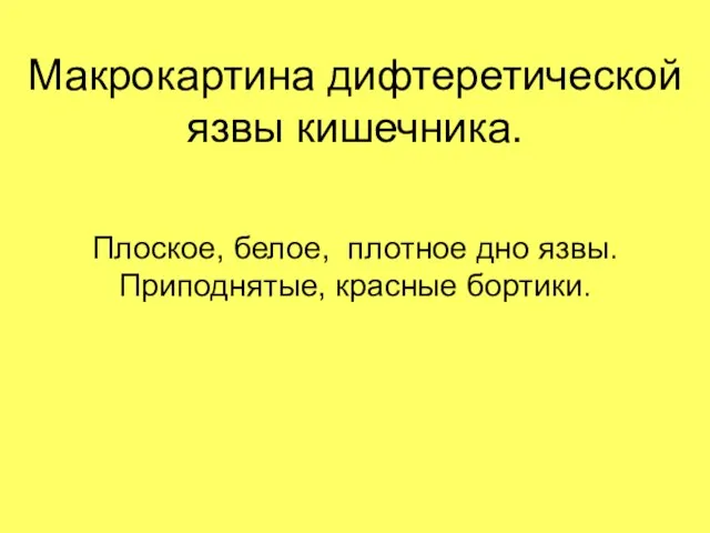 Макрокартина дифтеретической язвы кишечника. Плоское, белое, плотное дно язвы. Приподнятые, красные бортики.