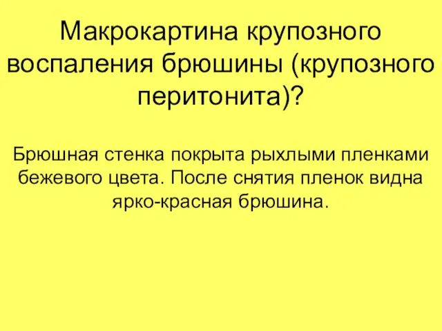 Макрокартина крупозного воспаления брюшины (крупозного перитонита)? Брюшная стенка покрыта рыхлыми пленками