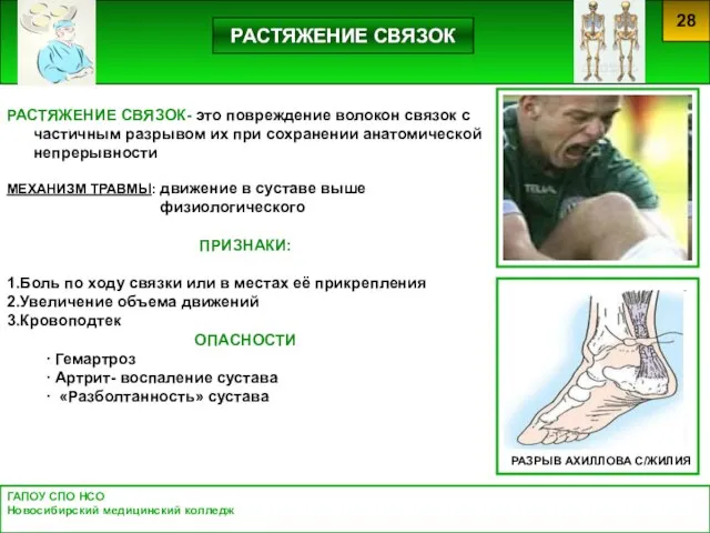 ГАПОУ СПО НСО Новосибирский медицинский колледж 28 РАСТЯЖЕНИЕ СВЯЗОК- это повреждение