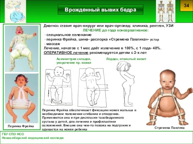 ГБУ СПО НСО Новосибирский медицинский колледж 34 Врожденный вывих бедра Перинка