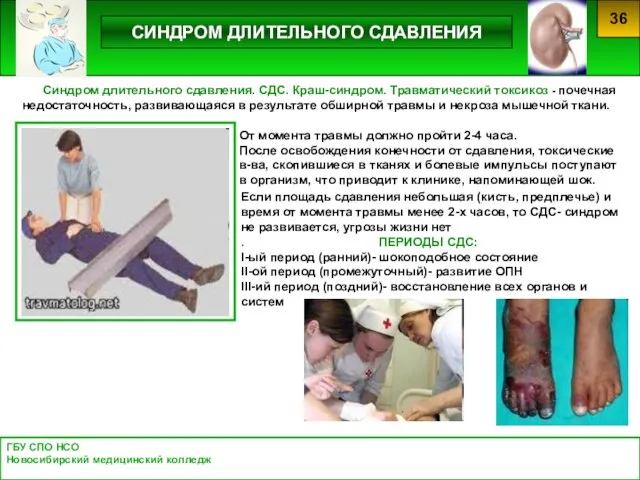 ГБУ СПО НСО Новосибирский медицинский колледж 36 СИНДРОМ ДЛИТЕЛЬНОГО СДАВЛЕНИЯ Синдром