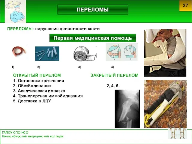 ГАПОУ СПО НСО Новосибирский медицинский колледж 37 ПЕРЕЛОМЫ Первая медицинская помощь