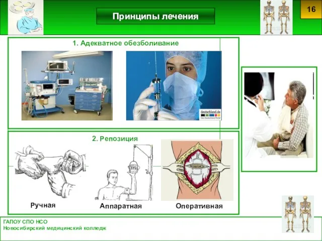 1. Адекватное обезболивание 2. Репозиция ГАПОУ СПО НСО Новосибирский медицинский колледж