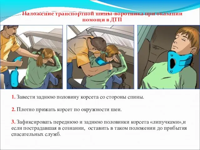 Наложение транспортной шины-воротника при оказании помощи в ДТП 1. Завести заднюю