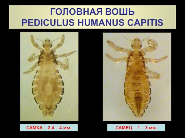 ГОЛОВНАЯ ВОШЬ PEDICULUS HUMANUS CAPITIS САМКА – 2,4 – 4 мм.
