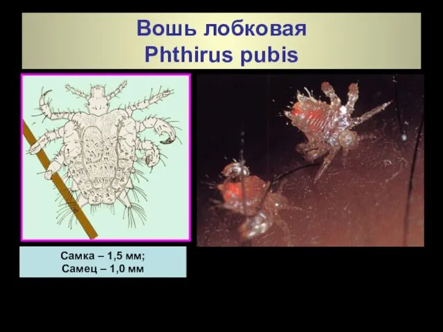 Вошь лобковая Phthirus pubis Самка – 1,5 мм; Самец – 1,0