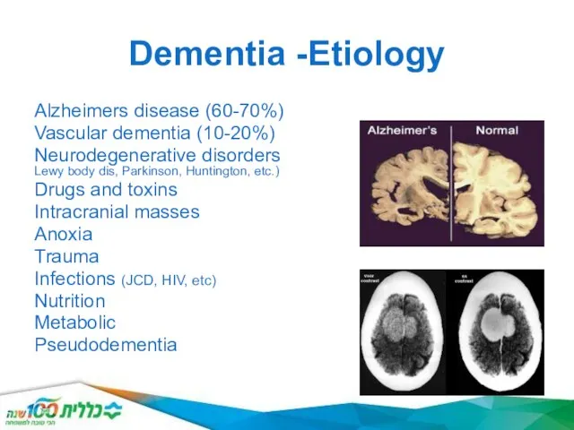 Dementia -Etiology Alzheimers disease (60-70%) Vascular dementia (10-20%) Neurodegenerative disorders (Pick,