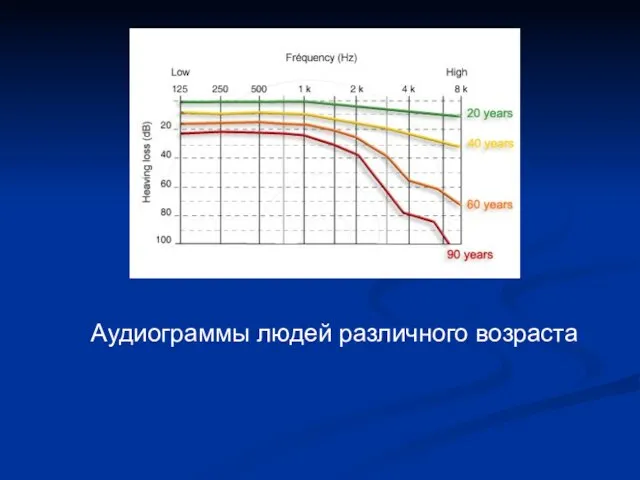 Аудиограммы людей различного возраста