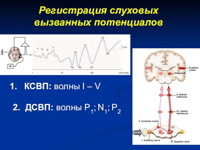 Регистрация слуховых вызванных потенциалов КСВП: волны I – V 2. ДСВП: волны P1; N1; P2