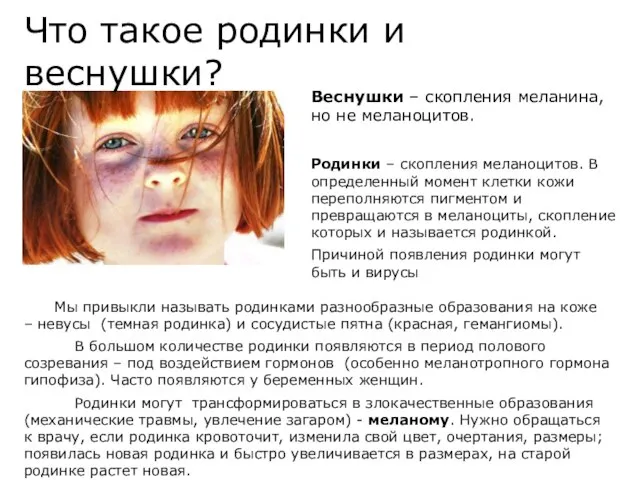 Что такое родинки и веснушки? Мы привыкли называть родинками разнообразные образования