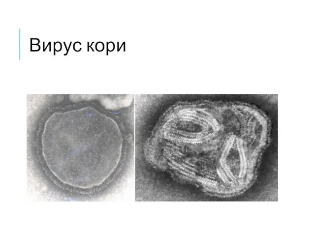 Вирус кори