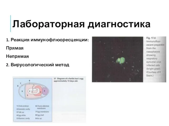 Лабораторная диагностика 1. Реакция иммунофлюоресценции: Прямая Непрямая 2. Вирусологический метод