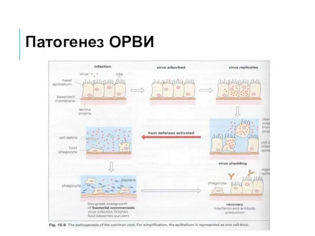 Патогенез ОРВИ