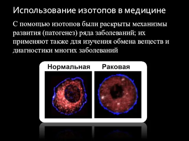 Использование изотопов в медицине С помощью изотопов были раскрыты механизмы развития