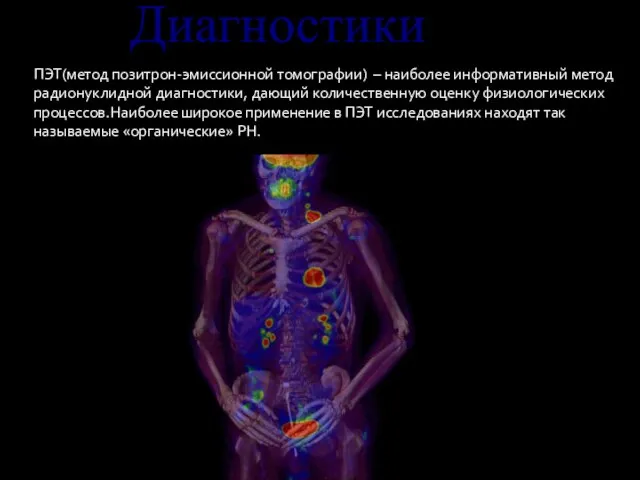 ПЭТ(метод позитрон-эмиссионной томографии) – наиболее информативный метод радионуклидной диагностики, дающий количественную