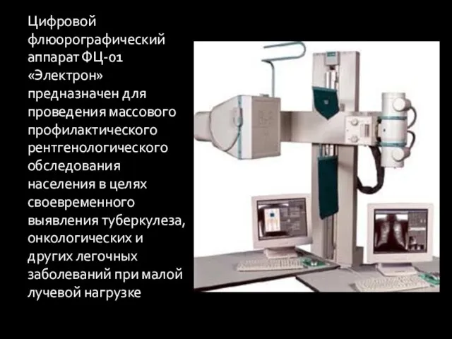 Цифровой флюорографический аппарат ФЦ-01 «Электрон» предназначен для проведения массового профилактического рентгенологического