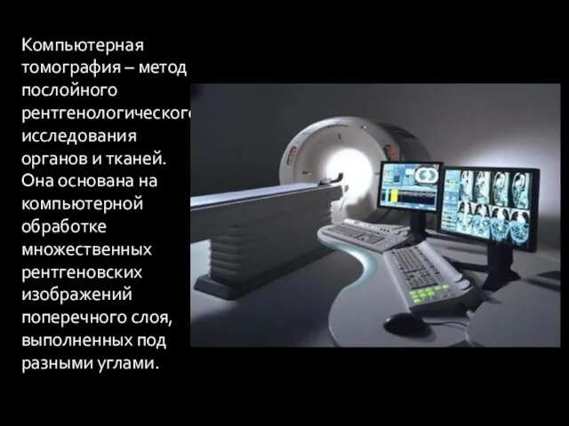 Компьютерная томография – метод послойного рентгенологического исследования органов и тканей. Она