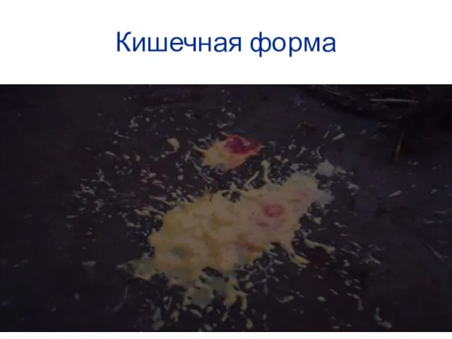 Кишечная форма