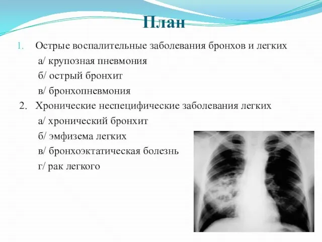 План Острые воспалительные заболевания бронхов и легких а/ крупозная пневмония б/