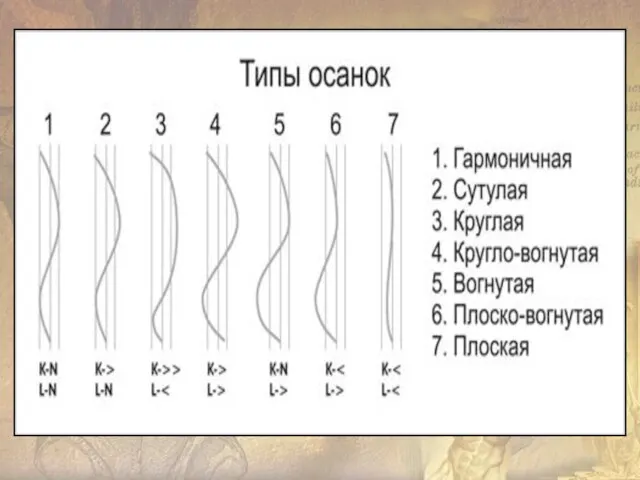 а- нормальная осанка; б- кифотическая осанка (круглая спина, сутулая спина); в-