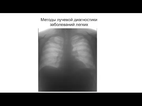 АКТУАЛЬНЫЕ ВОПРОСЫ РЕНТГЕНОЛОГИИ Методы лучевой диагностики заболеваний легких