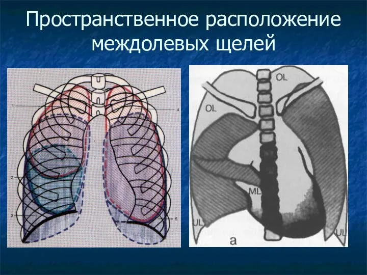 Пространственное расположение междолевых щелей