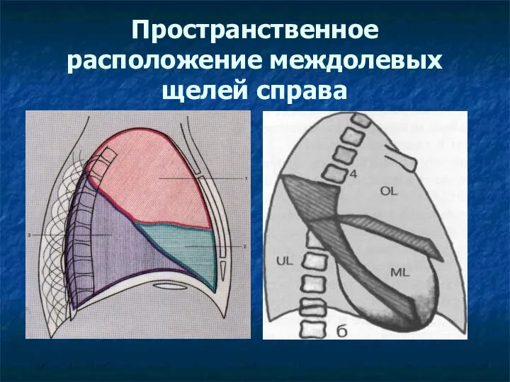 Пространственное расположение междолевых щелей справа