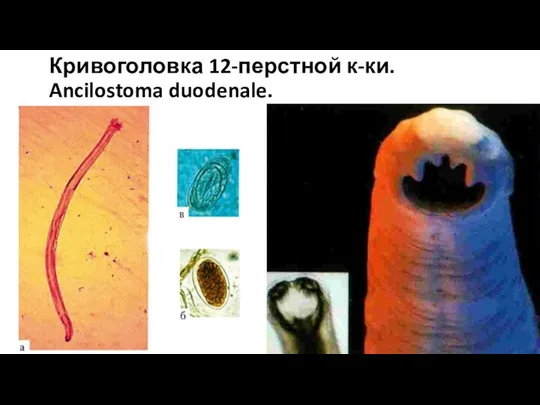 Кривоголовка 12-перстной к-ки. Ancilostoma duodenale.