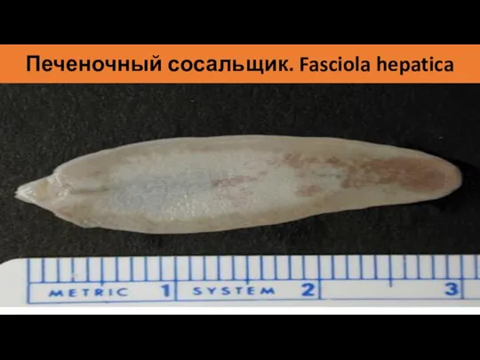 Печеночный сосальщик. Fasciola hepatica