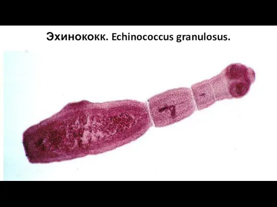 Эхинококк. Echinococcus granulosus.