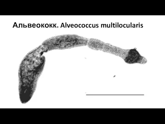 Альвеококк. Alveococcus multilocularis