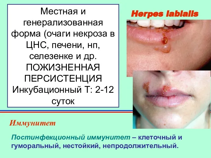 Herpes labialis Иммунитет Постинфекционный иммунитет – клеточный и гуморальный, нестойкий, непродолжительный.