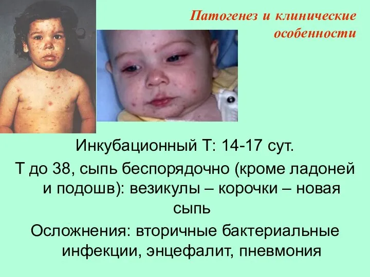 Инкубационный Т: 14-17 сут. T до 38, сыпь беспорядочно (кроме ладоней