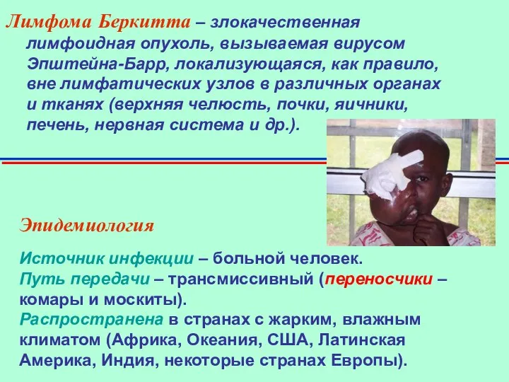 Лимфома Беркитта – злокачественная лимфоидная опухоль, вызываемая вирусом Эпштейна-Барр, локализующаяся, как