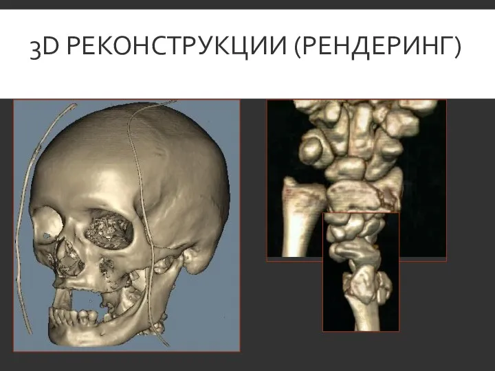 3D РЕКОНСТРУКЦИИ (РЕНДЕРИНГ)