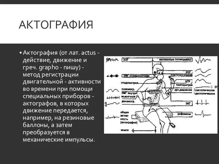 АКТОГРАФИЯ Актография (от лат. actus - действие, движение и греч. grapho