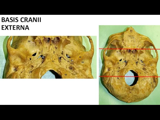 BASIS CRANII EXTERNA