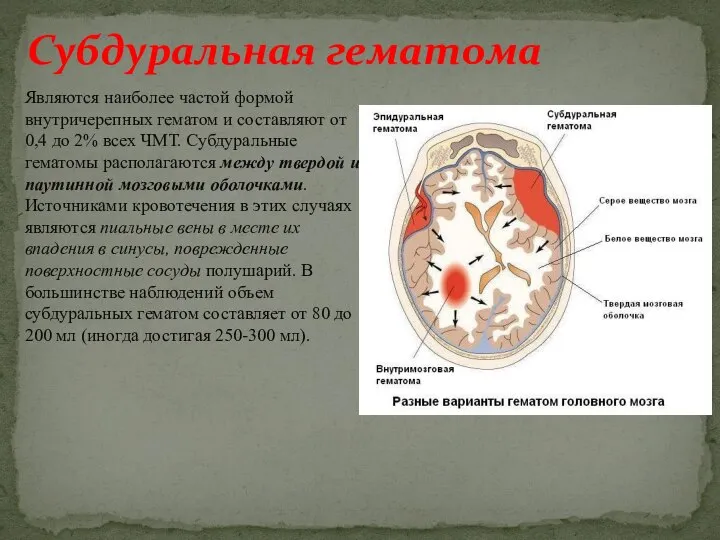 Являются наиболее частой формой внутричерепных гематом и составляют от 0,4 до