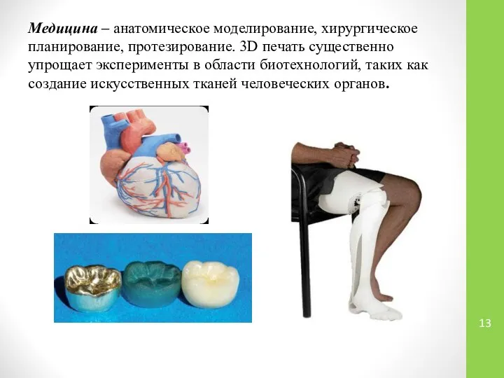 Медицина – анатомическое моделирование, хирургическое планирование, протезирование. 3D печать существенно упрощает