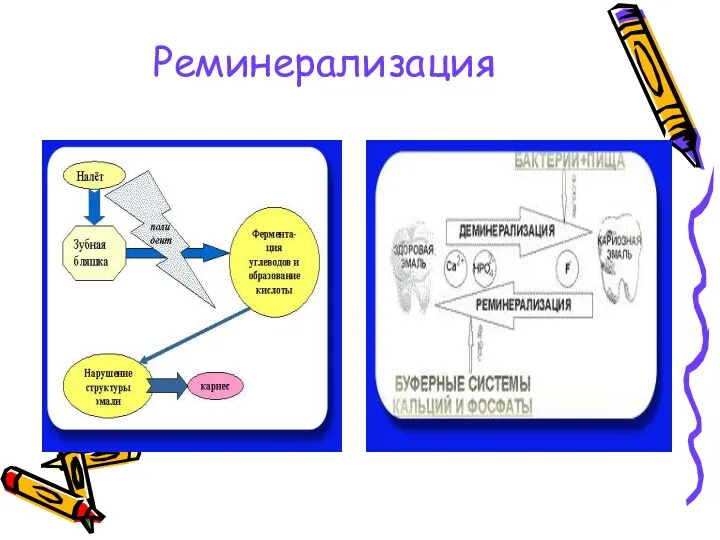 Реминерализация