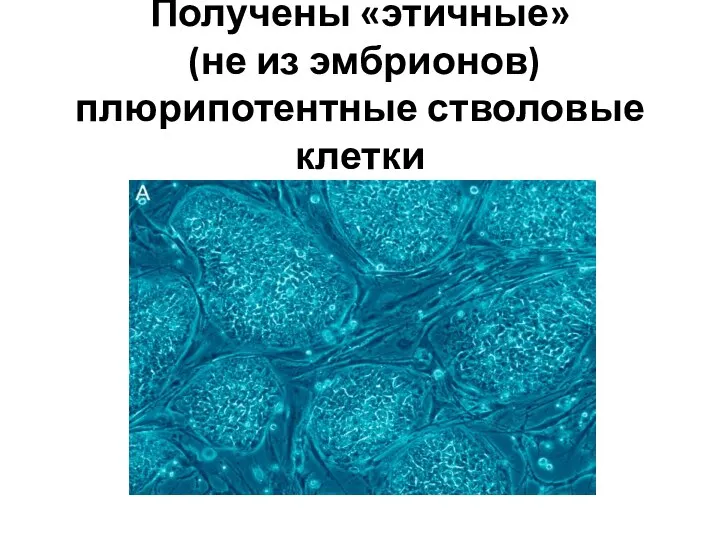 Получены «этичные» (не из эмбрионов) плюрипотентные стволовые клетки