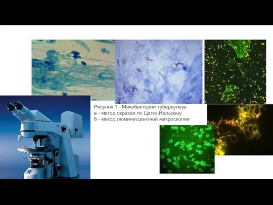 Рисунок 1 - Микобактерии туберкулеза а - метод окраски по Цилю-Нельсену б - метод люминисцентной микроскопии