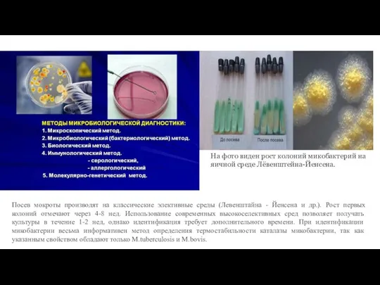 Посев мокроты производят на классические элективные среды (Левенштайна - Йенсена и
