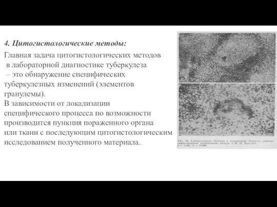 4. Цитогистологические методы: Главная задача цитогистологических методов в лабораторной диагностике туберкулеза